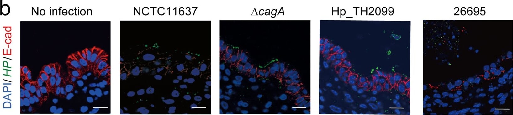 Detection of Human E-Cadherin by Immunocytochemistry/Immunofluorescence