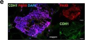 Detection of Human E-Cadherin by Immunocytochemistry/Immunofluorescence