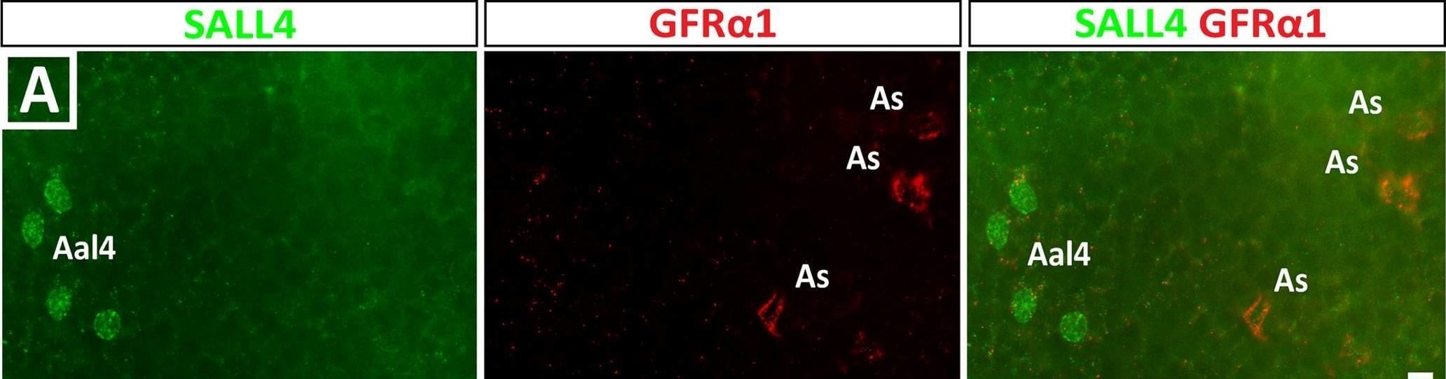 Detection of TROP-2 by Immunohistochemistry