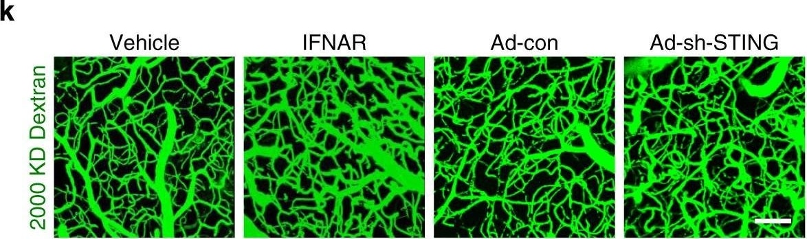 Detection of Mouse Human STING/TMEM173 Antibody by Immunohistochemistry