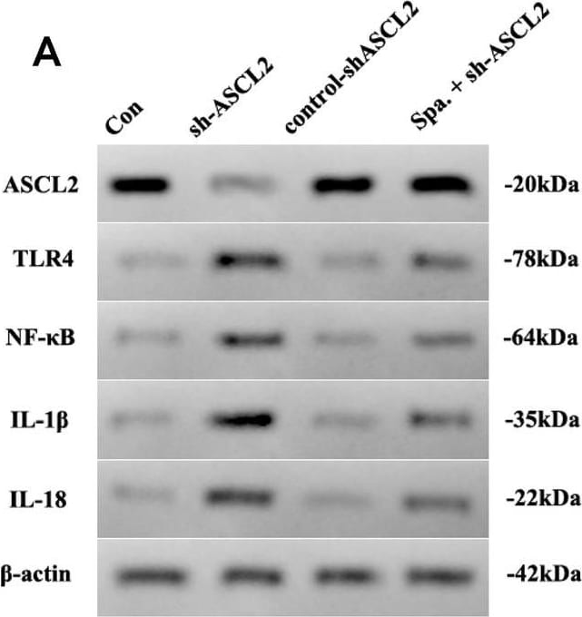 Detection of ASCL2/Mash2 by Western Blot