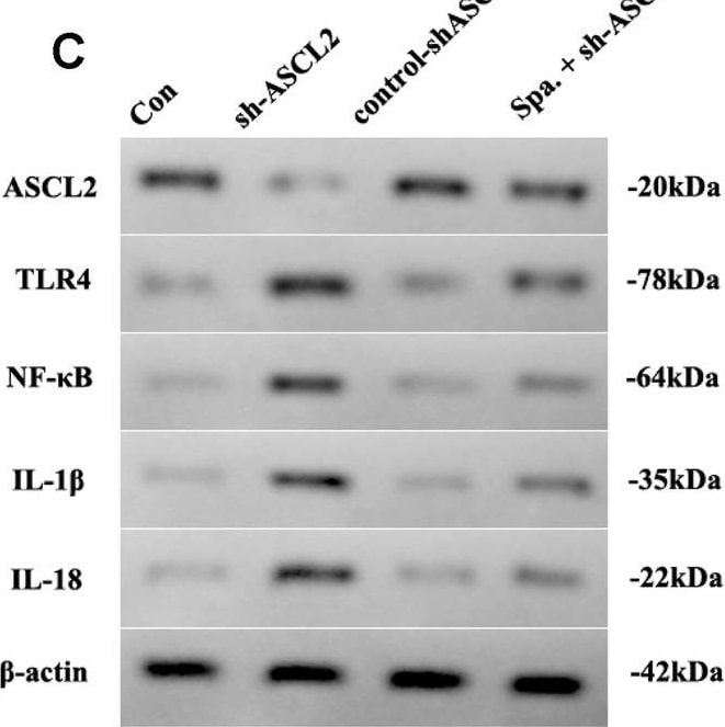 Detection of ASCL2/Mash2 by Western Blot