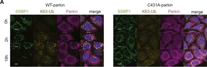 Detection of SSBP1 by Immunohistochemistry