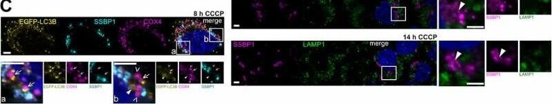 Detection of SSBP1 by Immunohistochemistry