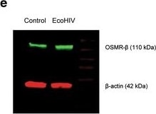 Detection of Mouse OSMR beta  by Western Blot