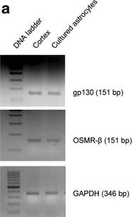 Detection of Mouse OSMR beta  by Western Blot