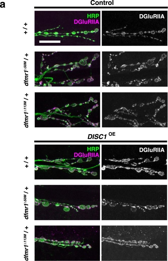 Detection of DISC1 by Immunohistochemistry