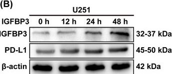 Detection of IGFBP-3 by Western Blot