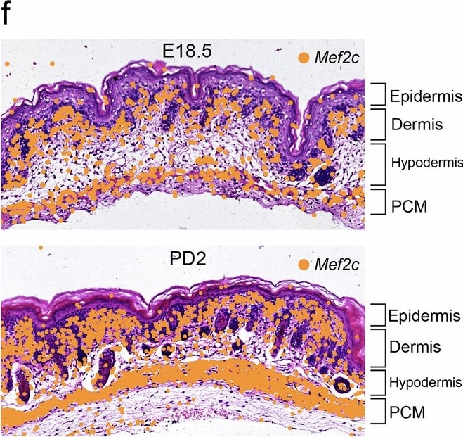 Detection of MEF2C by Immunohistochemistry