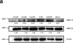 Detection of MMP-19 by Western Blot