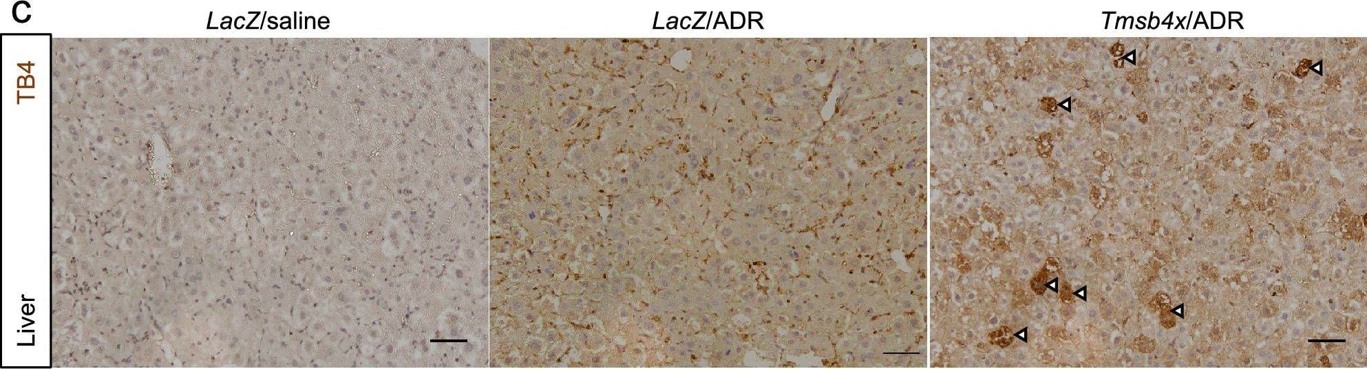 Detection of Thymosin beta 4 by Immunohistochemistry