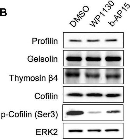Detection of Thymosin beta 4 by Western Blot