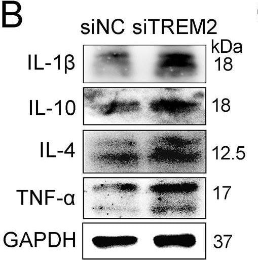 Detection of Porcine IL-1 beta /IL-1F2 by Western Blot
