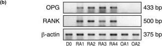 Detection of Human RANK/TNFRSF11A by Western Blot