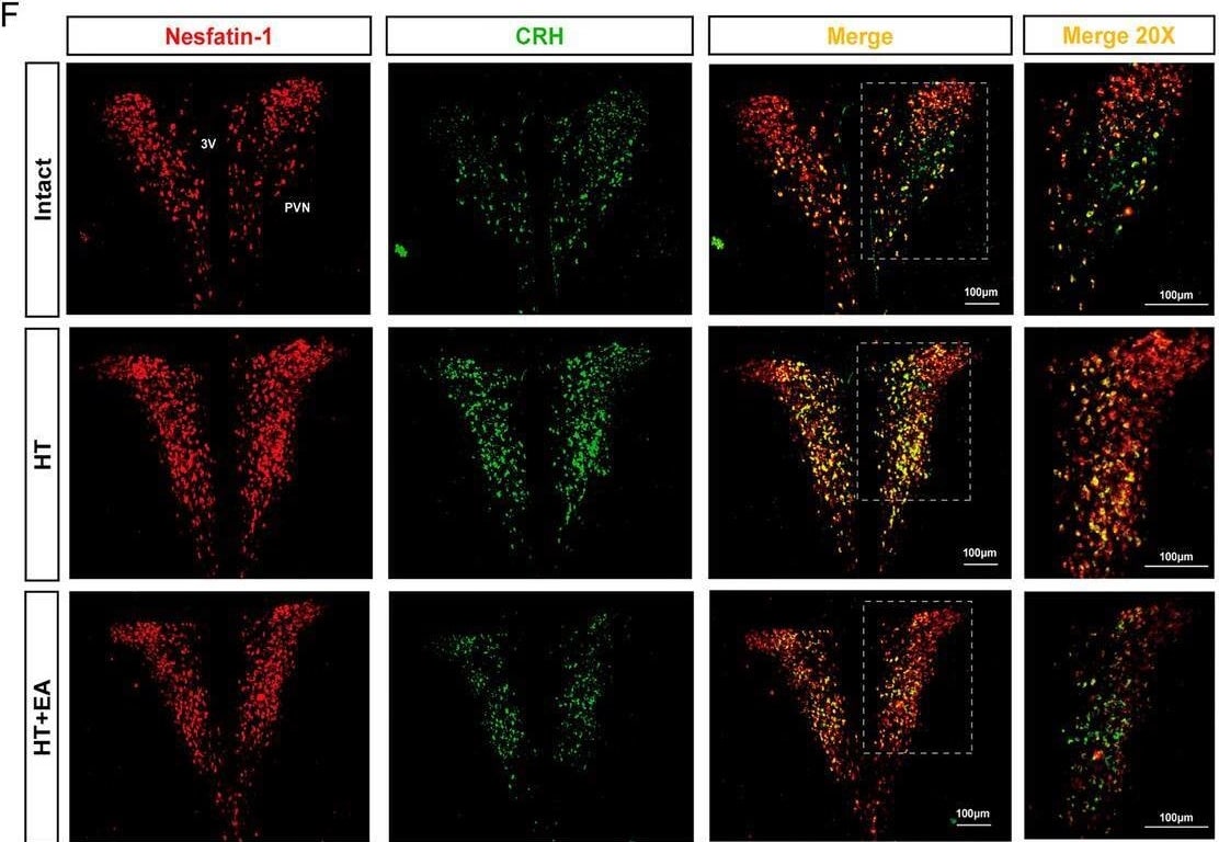 Detection of Nesfatin-1/Nucleobindin-2 by Immunocytochemistry/ Immunofluorescence