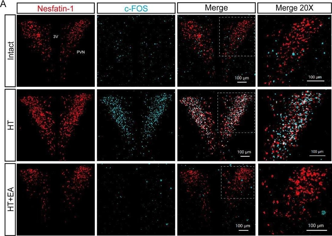 Detection of Nesfatin-1/Nucleobindin-2 by Immunocytochemistry/ Immunofluorescence