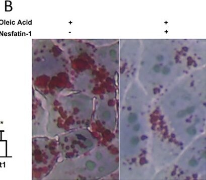 Detection of Nesfatin-1/Nucleobindin-2 by Immunohistochemistry
