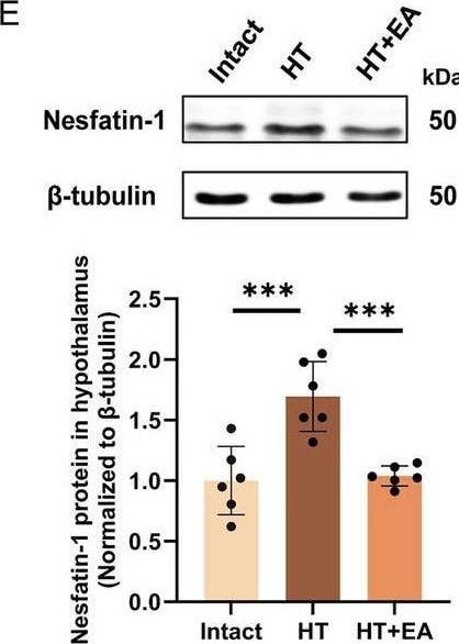 Detection of Nesfatin-1/Nucleobindin-2 by Western Blot