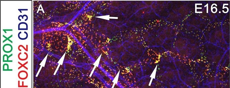Detection of Mouse Mouse FoxC2 Antibody by Immunohistochemistry