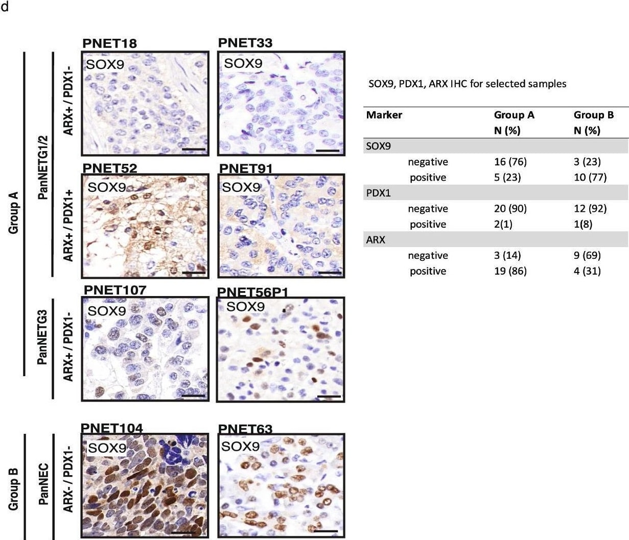 Detection of ARX by Immunohistochemistry