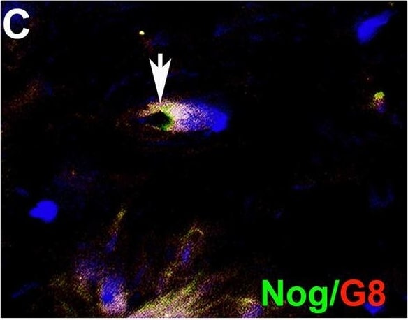 Detection of Human Noggin by Immunohistochemistry
