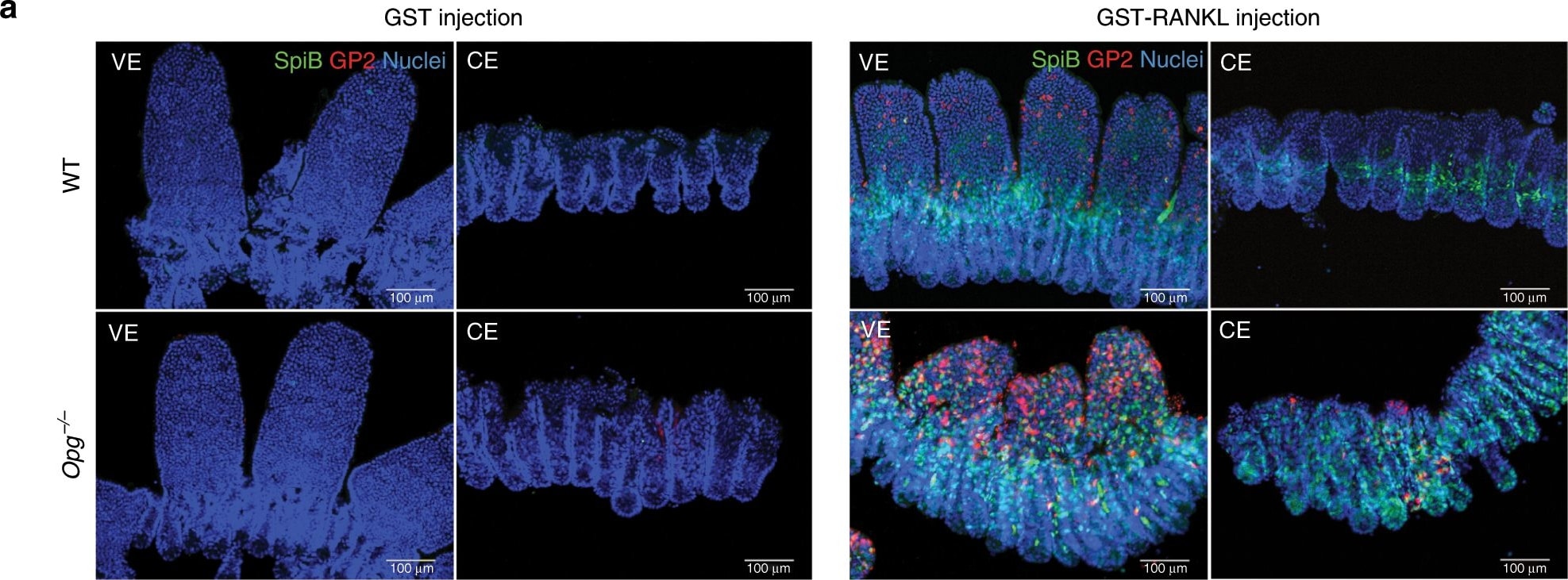 Detection of Mouse Spi-B by Immunocytochemistry/Immunofluorescence