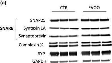 Detection of Mouse Syntaxin 1A by Western Blot