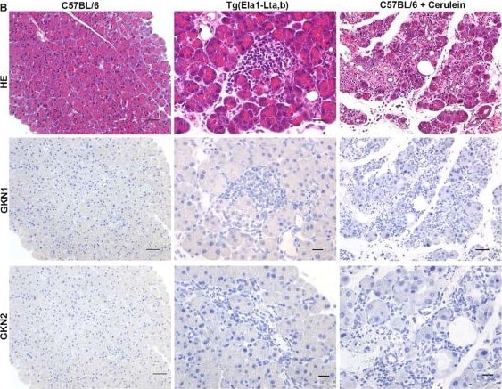 Detection of Gastrokine 1 by Immunohistochemistry