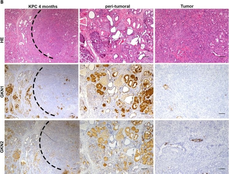 Detection of Gastrokine 1 by Immunohistochemistry