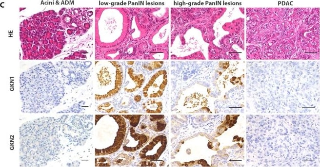 Detection of Gastrokine 1 by Immunohistochemistry