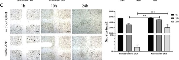 Detection of Gastrokine 1 by Immunohistochemistry