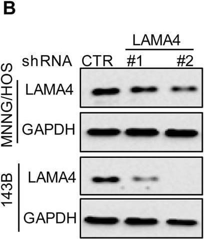 Detection of Laminin alpha 4 by Western Blot