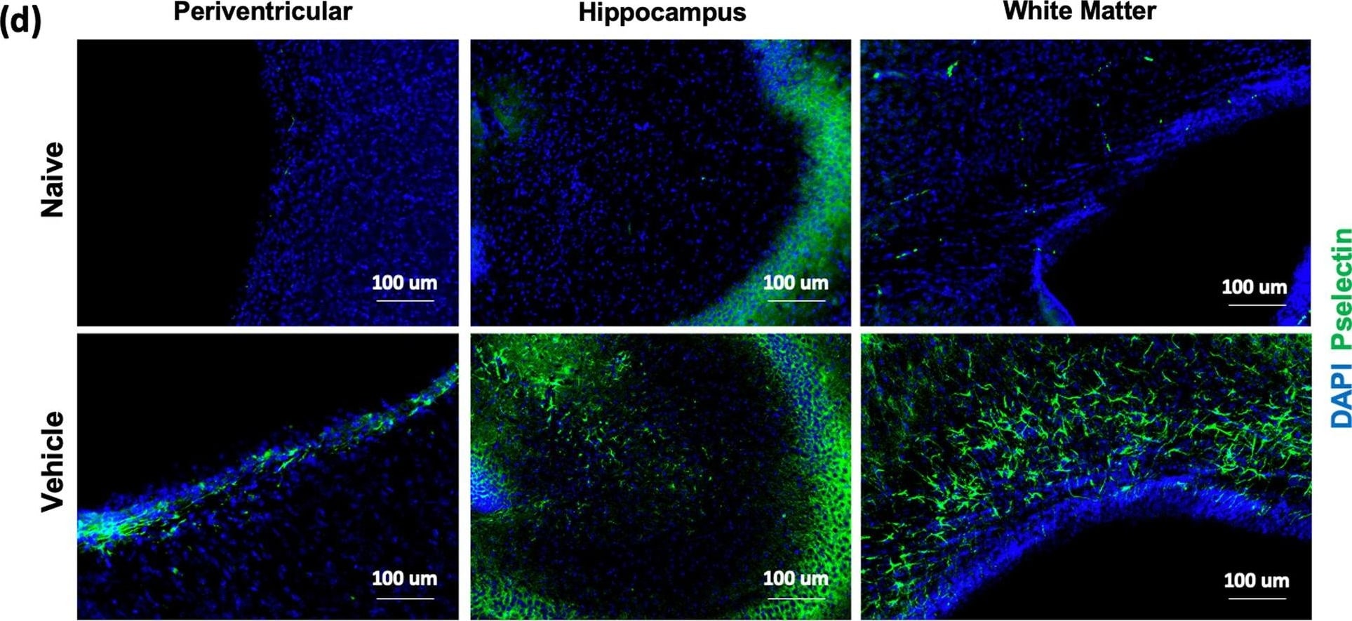Detection of P-Selectin/CD62P by Immunohistochemistry