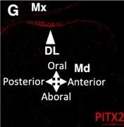 Detection of PITX2 by Immunohistochemistry