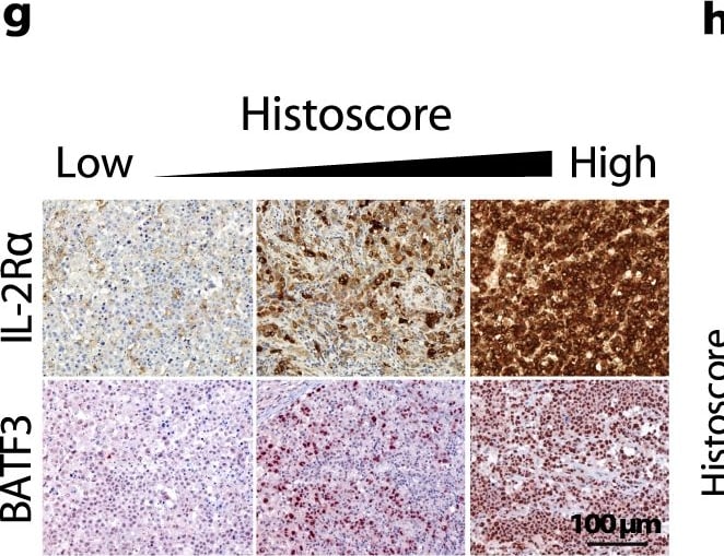 Detection of BATF3 by Immunohistochemistry