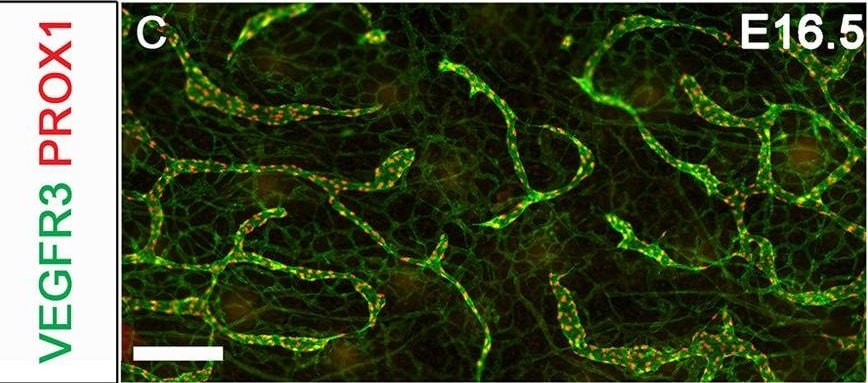 Detection of Mouse Mouse VEGFR3/Flt-4 Antibody by Immunohistochemistry