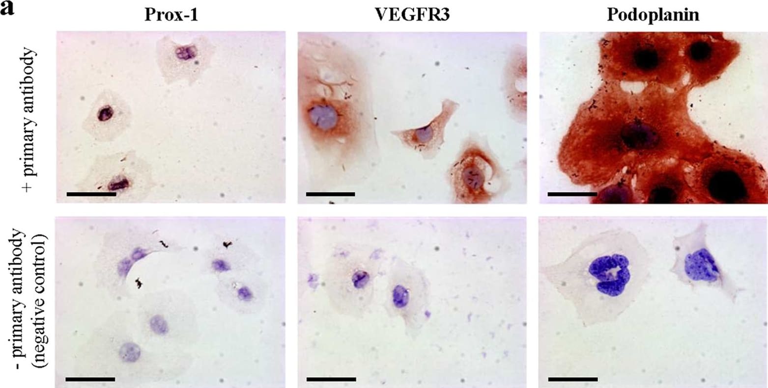 Detection of Mouse Mouse VEGFR3/Flt-4 Antibody by Immunohistochemistry