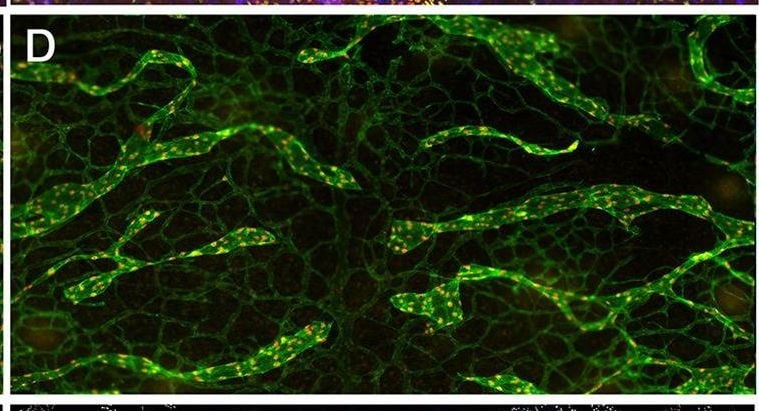 Detection of Mouse Mouse VEGFR3/Flt-4 Antibody by Immunohistochemistry