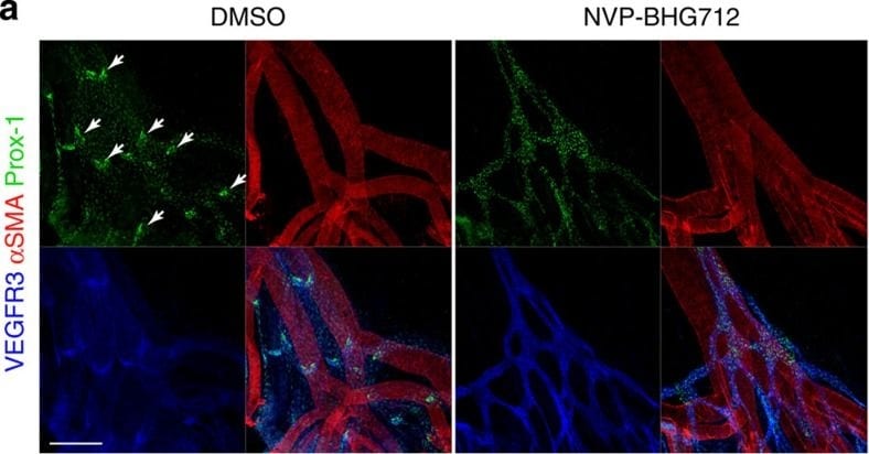 Detection of Mouse VEGFR3/Flt-4 by Immunohistochemistry