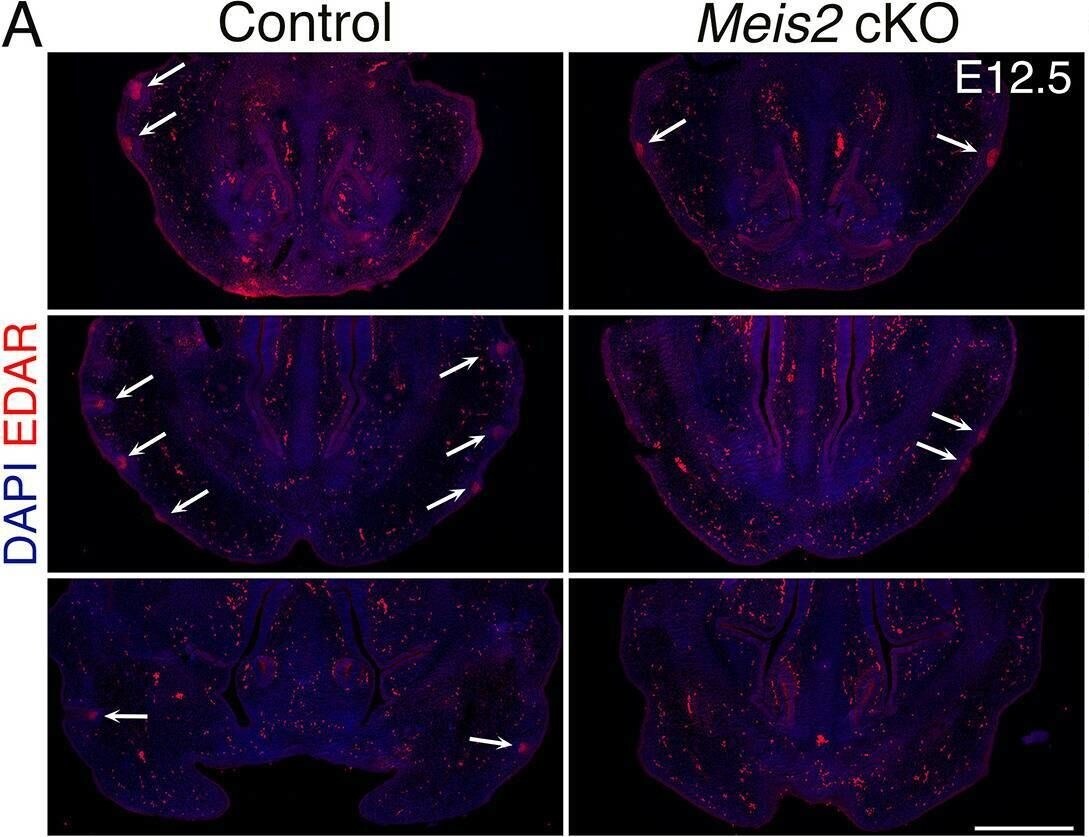 Detection of EDAR by Immunohistochemistry