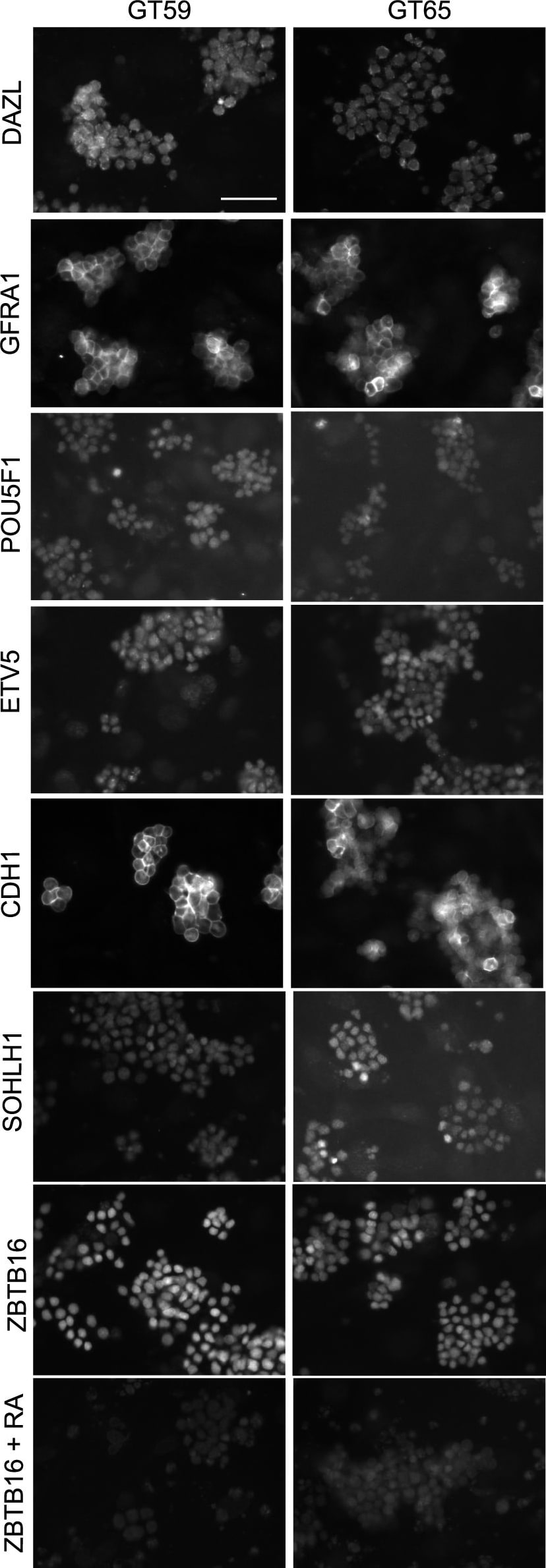 Detection of Mouse E-Cadherin by Immunocytochemistry/Immunofluorescence