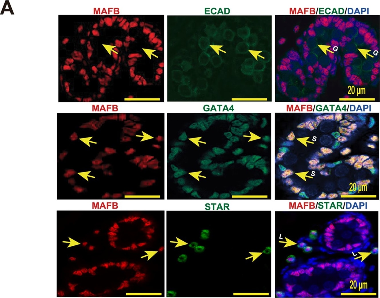 Detection of Mouse E-Cadherin by Immunocytochemistry/Immunofluorescence