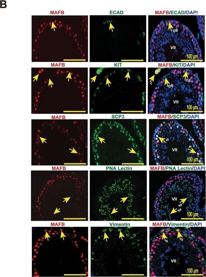 Detection of Mouse E-Cadherin by Immunocytochemistry/Immunofluorescence