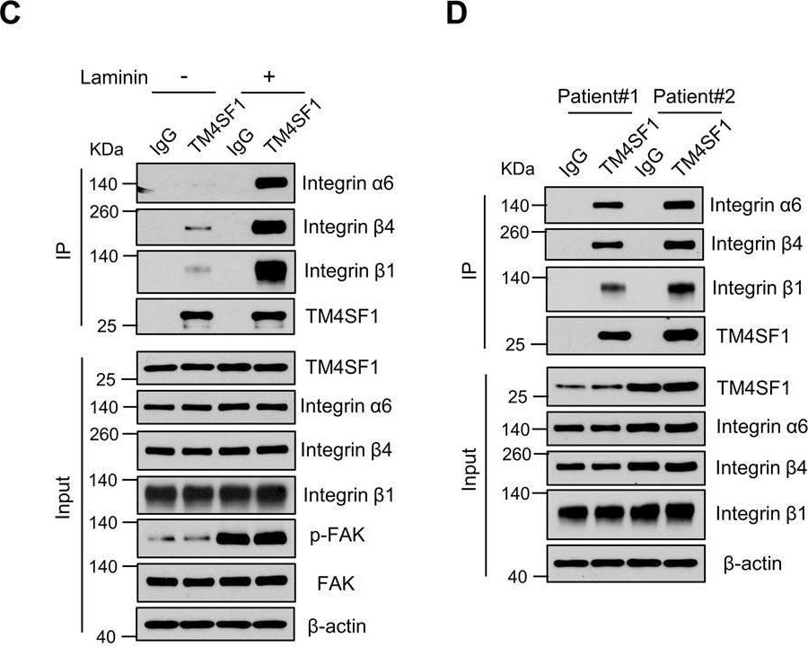 Detection of Human TM4SF1 by Western Blot