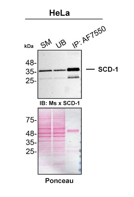 Detection of SCD-1 by Immunoprecipitation.