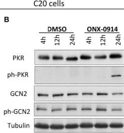 Detection of Phospho-GCN2 (T899) by Western Blot