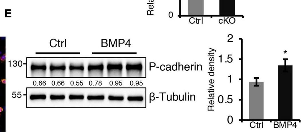 Detection of Mouse P-Cadherin by Western Blot