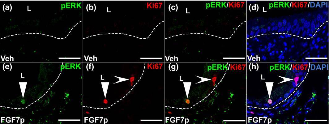 Detection of Ki67/MKI67 by Immunohistochemistry