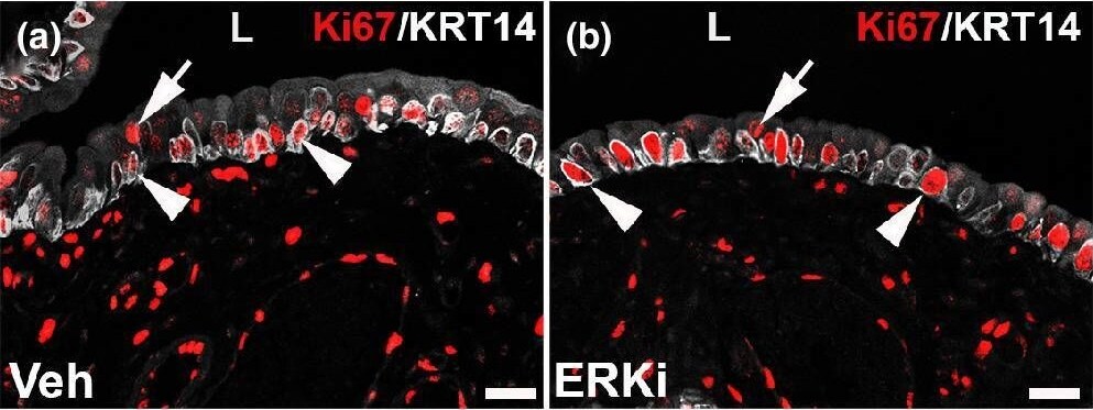 Detection of Ki67/MKI67 by Immunohistochemistry