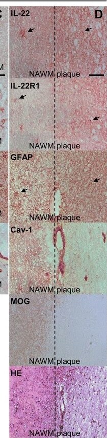 Detection of Human Human IL-22 Antibody by Immunohistochemistry